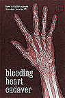 Bleeding Heart Cadaver (Down in the Dirt book) issue collection book